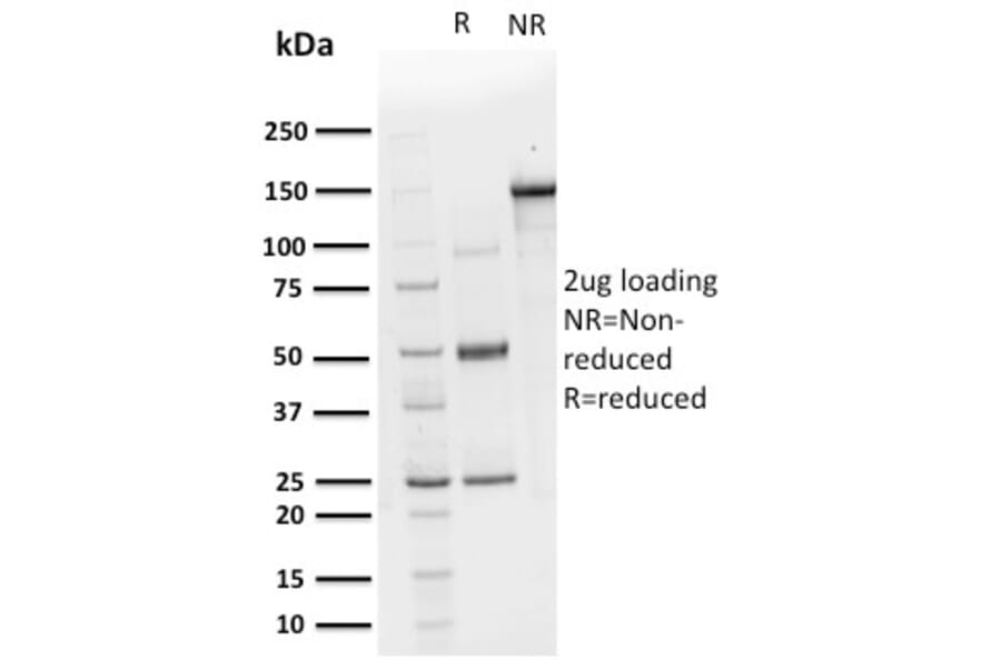 SDS-PAGE - Anti-CHP2 Antibody [CPTC-CHP2-1] (A249949) - Antibodies.com