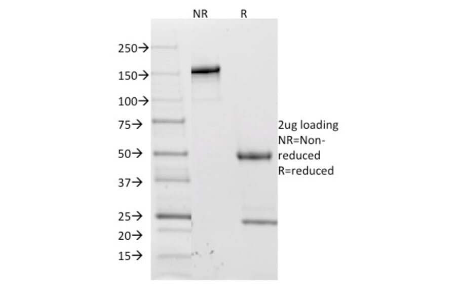 SDS-PAGE - Anti-CD62L Antibody [CD62L/1588] (A249949) - Antibodies.com