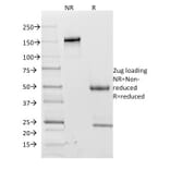 SDS-PAGE - Anti-CD62L Antibody [CD62L/1588] (A249949) - Antibodies.com