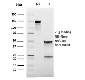 SDS-PAGE - Anti-CD62L Antibody [LAM1-116] (A249950) - Antibodies.com