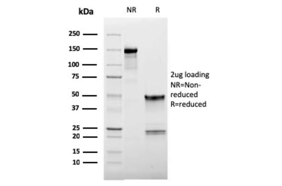 SDS-PAGE - Anti-CD62L Antibody [LAM1-116] (A249950) - Antibodies.com