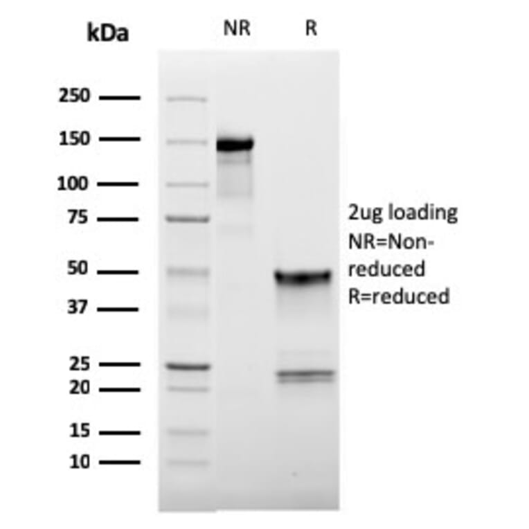 SDS-PAGE - Anti-CD62L Antibody [LAM1-116] (A249950) - Antibodies.com