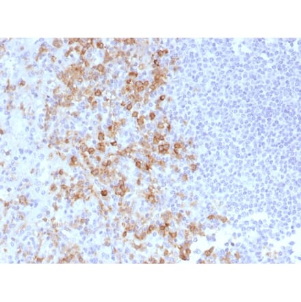 Immunohistochemistry - Anti-CD162 Antibody [PSGL1/1601] (A249951) - Antibodies.com