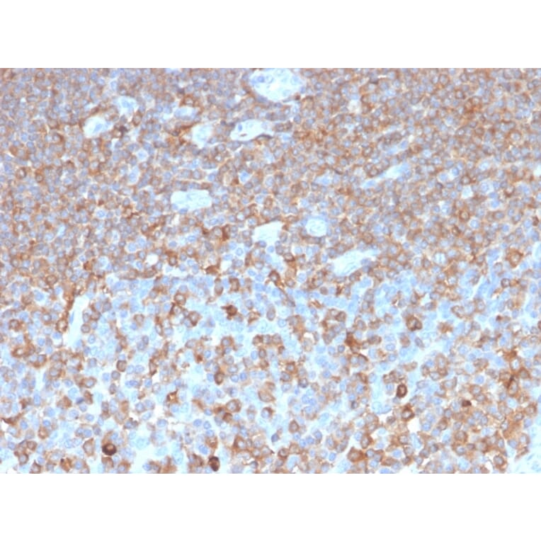 Immunohistochemistry - Anti-gamma Parvin Antibody [PARVG/6312R] (A249955) - Antibodies.com