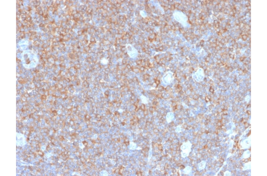 Immunohistochemistry - Anti-gamma Parvin Antibody [PARVG/6312R] (A249953) - Antibodies.com