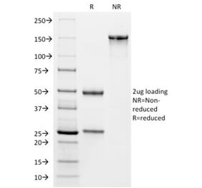 SDS-PAGE - Anti-VISTA Antibody [VISTA/2864] (A249956) - Antibodies.com