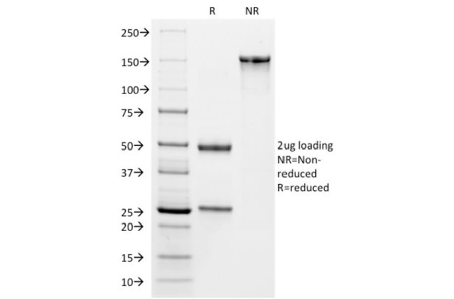 SDS-PAGE - Anti-VISTA Antibody [VISTA/2864] (A249956) - Antibodies.com