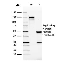 SDS-PAGE - Anti-VISTA Antibody [VISTA/2865] (A249957) - Antibodies.com