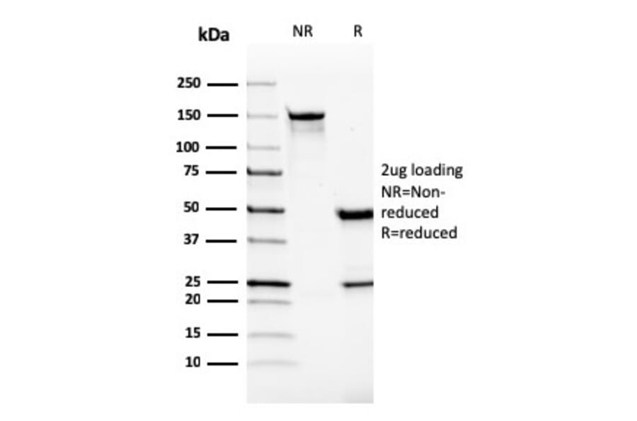 SDS-PAGE - Anti-VISTA Antibody [VISTA/2865] (A249957) - Antibodies.com