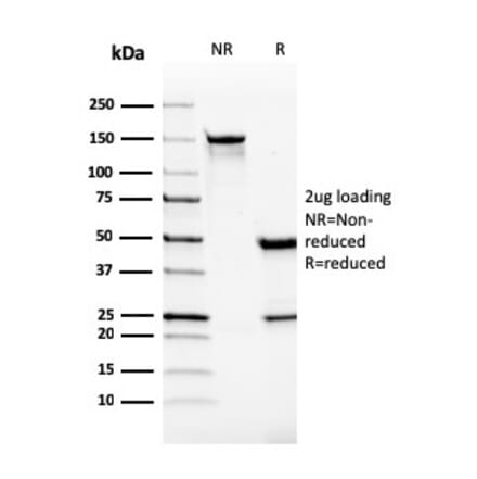 SDS-PAGE - Anti-VISTA Antibody [VISTA/2865] (A249957) - Antibodies.com