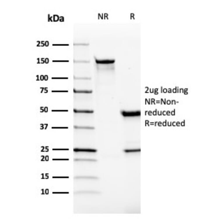 SDS-PAGE - Anti-VISTA Antibody [VISTA/2865] (A249957) - Antibodies.com