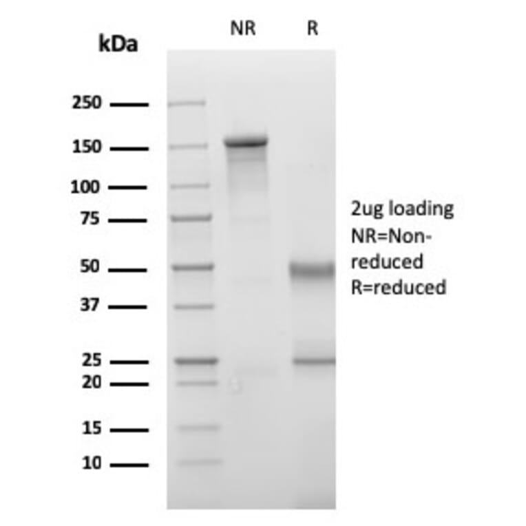 SDS-PAGE - Anti-VISTA Antibody [VISTA/3006] (A249958) - Antibodies.com
