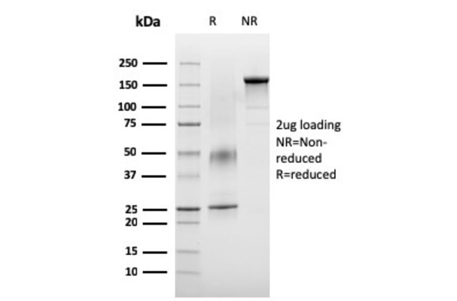 SDS-PAGE - Anti-VISTA Antibody [VISTA/3007] (A249959) - Antibodies.com