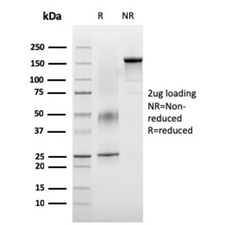 SDS-PAGE - Anti-VISTA Antibody [VISTA/3007] (A249959) - Antibodies.com