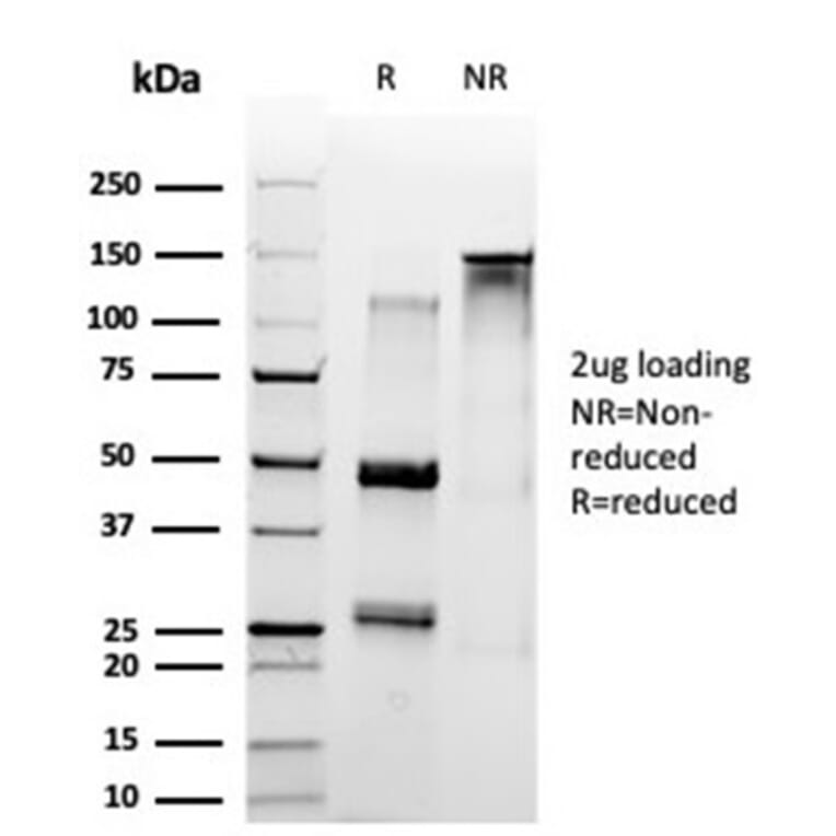 SDS-PAGE - Anti-SET Antibody [PCRP-SET-1C6] (A249960) - Antibodies.com