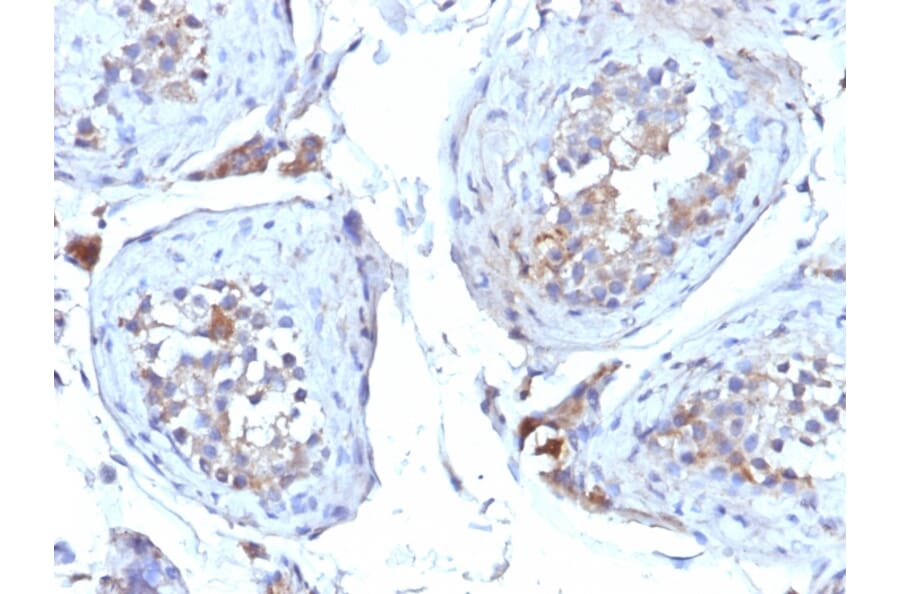 Immunohistochemistry - Anti-Sex Hormone Binding Globulin Antibody [SHBG/245] (A249961) - Antibodies.com
