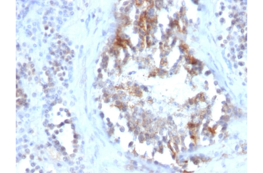 Immunohistochemistry - Anti-Sex Hormone Binding Globulin Antibody [SPM605] (A249962) - Antibodies.com