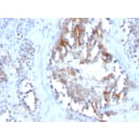 Immunohistochemistry - Anti-Sex Hormone Binding Globulin Antibody [SPM605] (A249962) - Antibodies.com