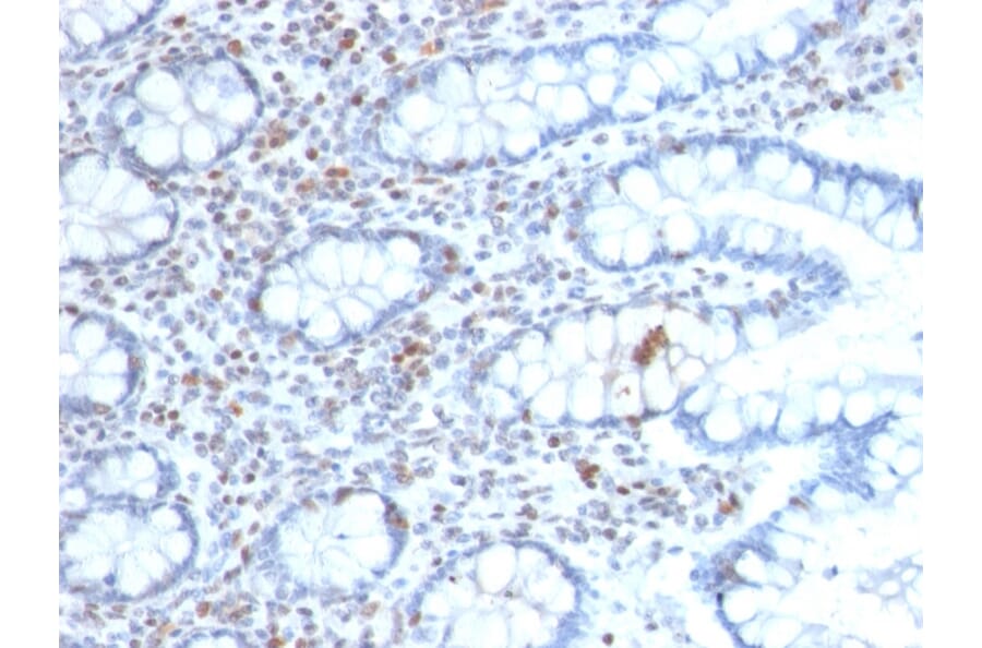 Immunohistochemistry - Anti-BMI1 Antibody [BMI1/2689] (A249964) - Antibodies.com