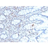 Immunohistochemistry - Anti-BMI1 Antibody [BMI1/2689] (A249964) - Antibodies.com