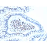 Immunohistochemistry - Anti-BMI1 Antibody [BMI1/2689] (A249964) - Antibodies.com