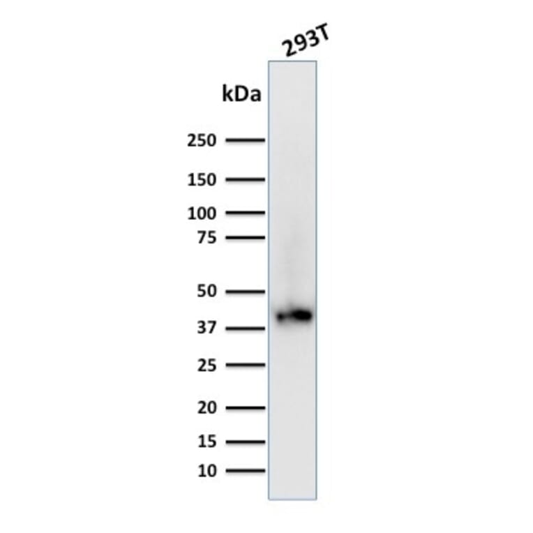 Western Blot - Anti-BMI1 Antibody [BMI1/2689] (A249964) - Antibodies.com