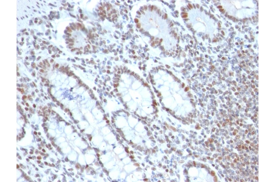 Immunohistochemistry - Anti-BMI1 Antibody [BMI1/2690] (A249965) - Antibodies.com