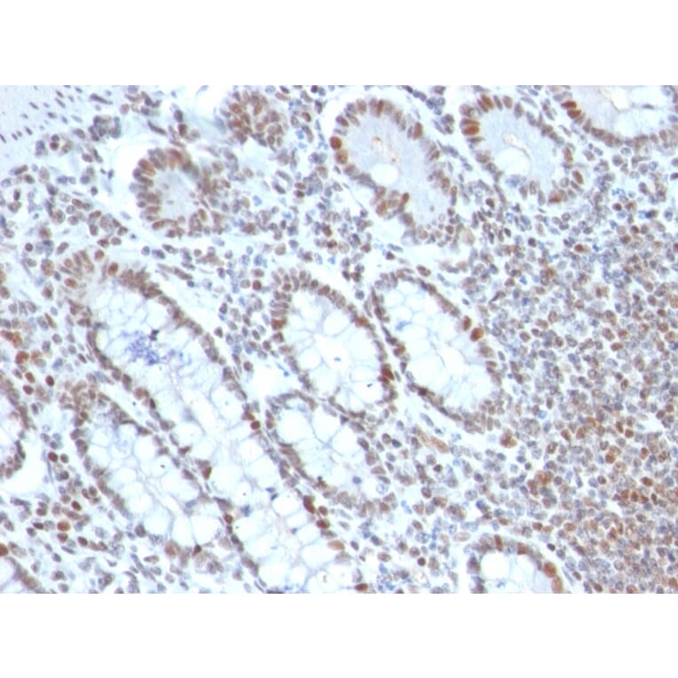 Immunohistochemistry - Anti-BMI1 Antibody [BMI1/2690] (A249965) - Antibodies.com