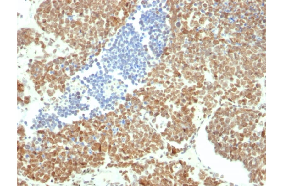 Immunohistochemistry - Anti-BMI1 Antibody [BMI1/2690] (A249965) - Antibodies.com
