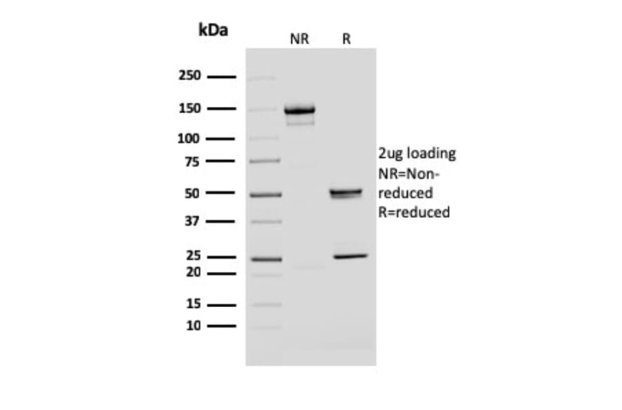 SDS-PAGE - Anti-BMI1 Antibody [BMI1/2690] (A249965) - Antibodies.com