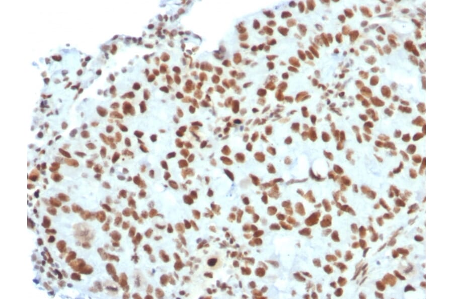 Immunohistochemistry - Anti-BMI1 Antibody [BMI1/2823] (A249966) - Antibodies.com