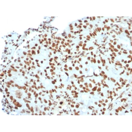 Immunohistochemistry - Anti-BMI1 Antibody [BMI1/2823] (A249966) - Antibodies.com