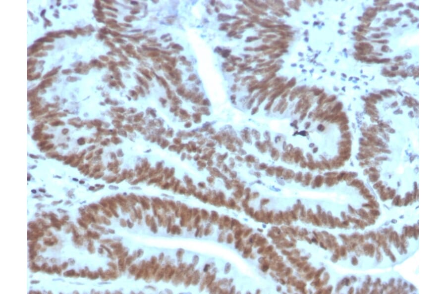 Immunohistochemistry - Anti-BMI1 Antibody [BMI1/2823] (A249966) - Antibodies.com