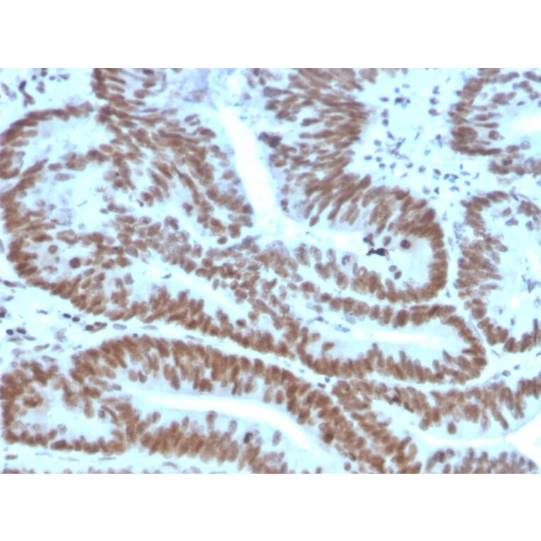Immunohistochemistry - Anti-BMI1 Antibody [BMI1/2823] (A249966) - Antibodies.com