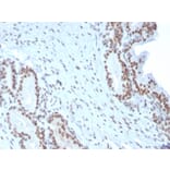 Immunohistochemistry - Anti-BMI1 Antibody [BMI1/2823] (A249966) - Antibodies.com