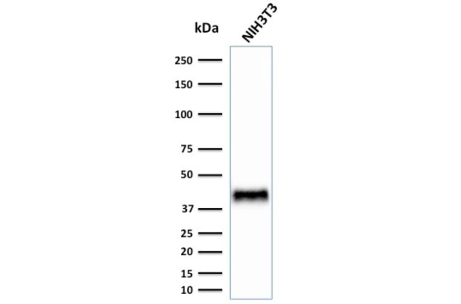 Western Blot - Anti-BMI1 Antibody [BMI1/2823] (A249966) - Antibodies.com