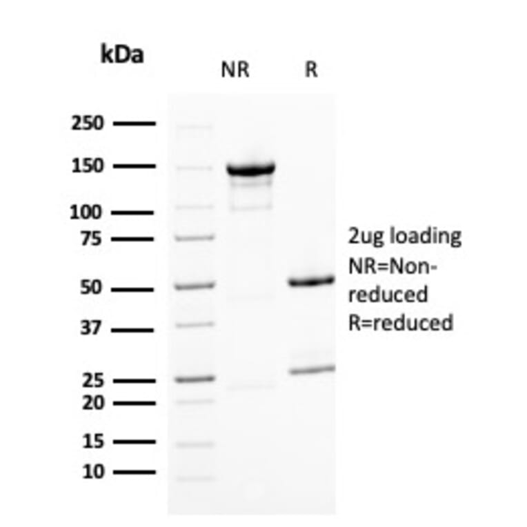 SDS-PAGE - Anti-BMI1 Antibody [BMI1/2823] (A249966) - Antibodies.com