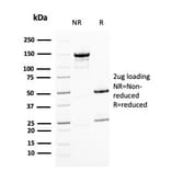 SDS-PAGE - Anti-BMI1 Antibody [BMI1/2823] (A249966) - Antibodies.com