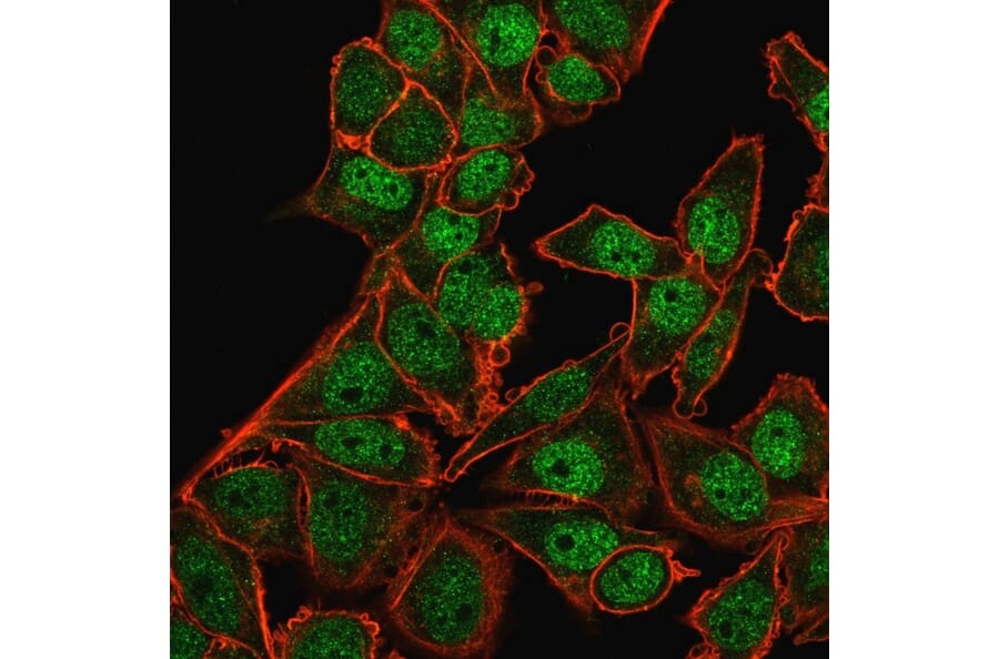 Immunofluorescence - Anti-BMI1 Antibody [BMI1/2823] (A249966) - Antibodies.com