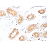 Immunohistochemistry - Anti-Melanoma gp100 Antibody [HMB45] (A249967) - Antibodies.com