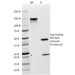 SDS-PAGE - Anti-Melanoma gp100 Antibody [HMB45] (A249967) - Antibodies.com