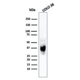 Western Blot - Anti-Melanoma gp100 Antibody [HMB45] (A249967) - Antibodies.com