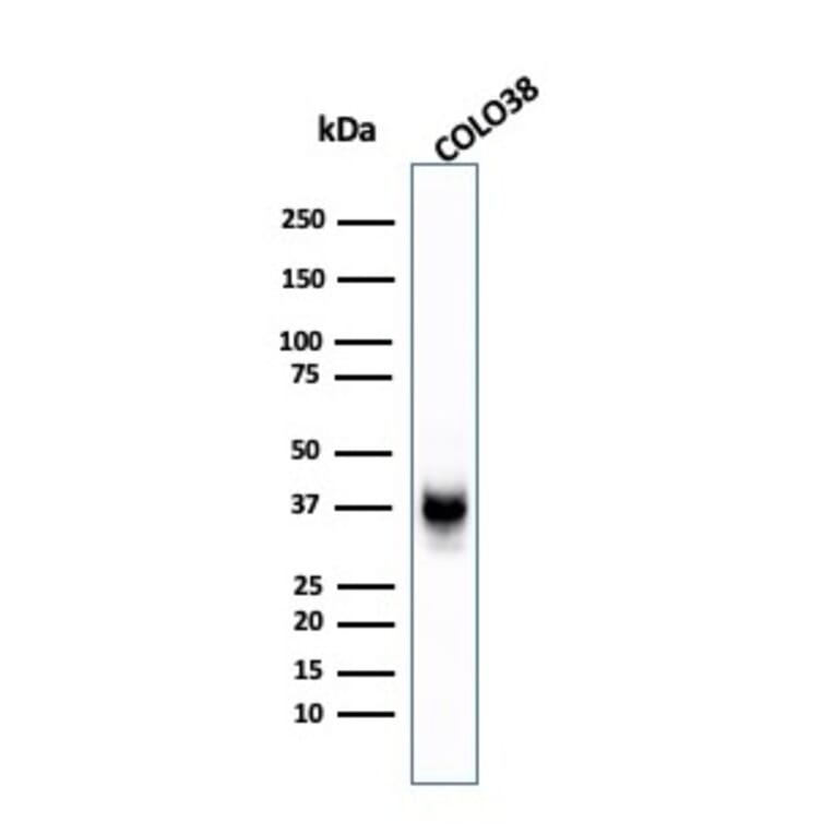Western Blot - Anti-Melanoma gp100 Antibody [SPM142] (A249968) - Antibodies.com