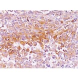 Immunohistochemistry - Anti-Melanoma gp100 Antibody [NKI-beteb] (A249969) - Antibodies.com