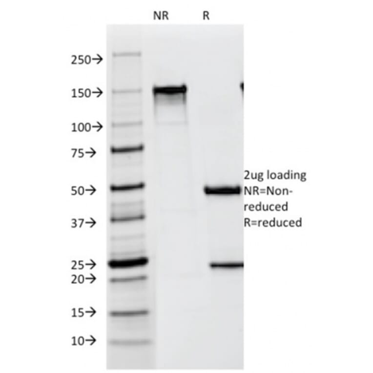 SDS-PAGE - Anti-Melanoma gp100 Antibody [NKI-beteb] (A249969) - Antibodies.com