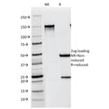 SDS-PAGE - Anti-Melanoma gp100 Antibody [NKI-beteb] (A249969) - Antibodies.com