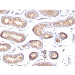 Immunohistochemistry - Anti-Melanoma gp100 Antibody [PMEL/783] (A249971) - Antibodies.com