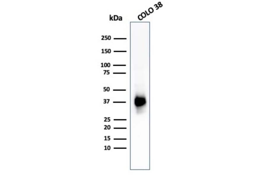 Western Blot - Anti-Melanoma gp100 Antibody [PMEL/783] (A249971) - Antibodies.com