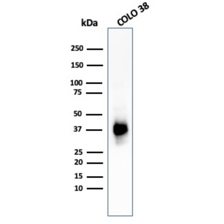 Western Blot - Anti-Melanoma gp100 Antibody [PMEL/783] (A249971) - Antibodies.com