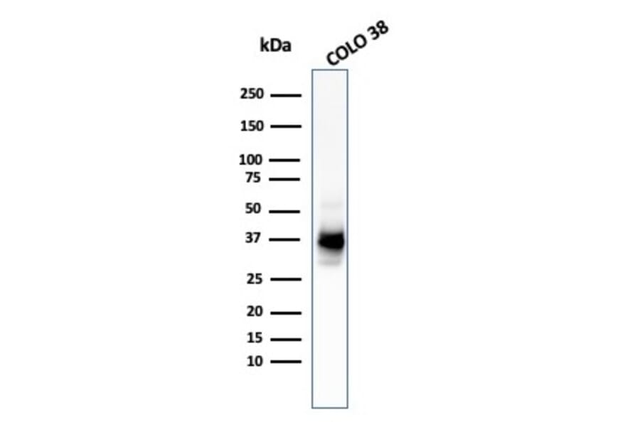 Western Blot - Anti-Melanoma gp100 Antibody [HMB45 + PMEL/783] (A249972) - Antibodies.com
